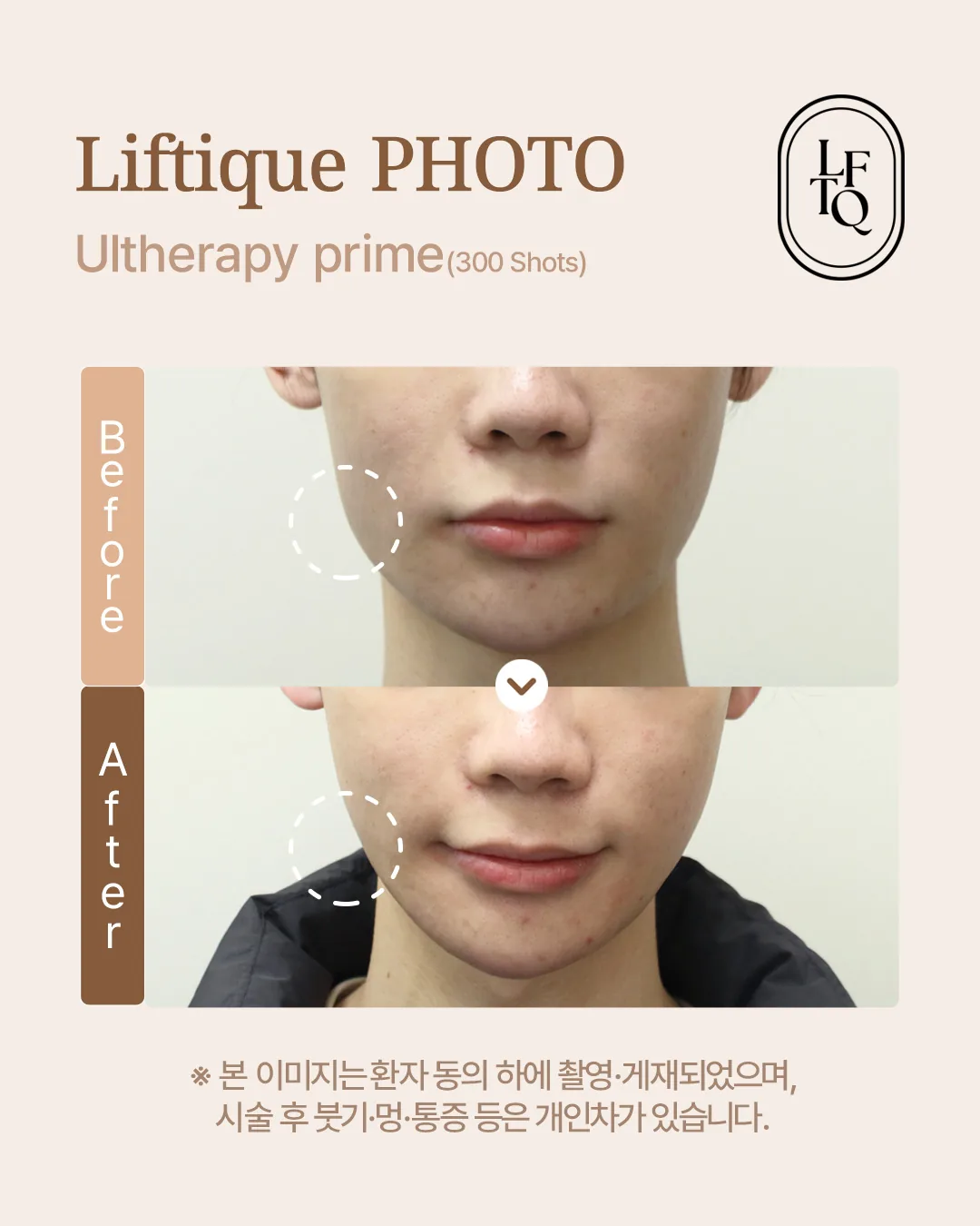 공식 사례 8