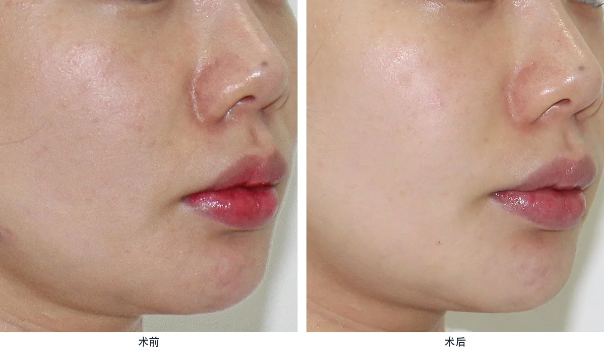 Official before-and-after cases 18