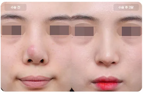 BYUL 美容外科