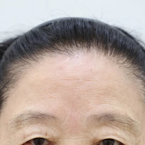 병원 공개 사례 이미지