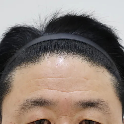 병원 공개 사례 이미지