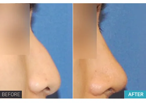Kasus resmi 2