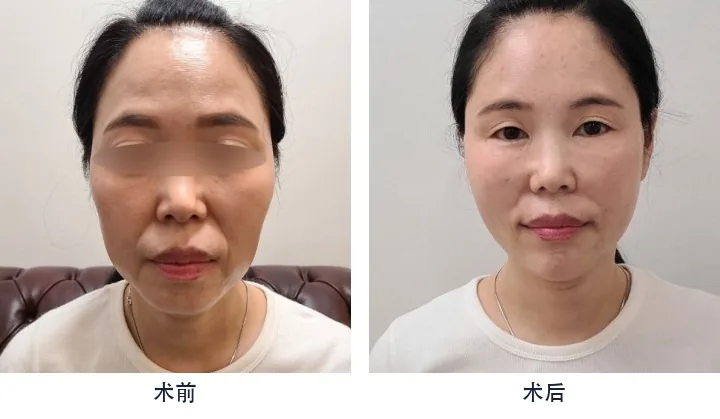 Official before-and-after cases 7