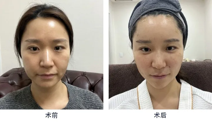 Official before-and-after cases 6