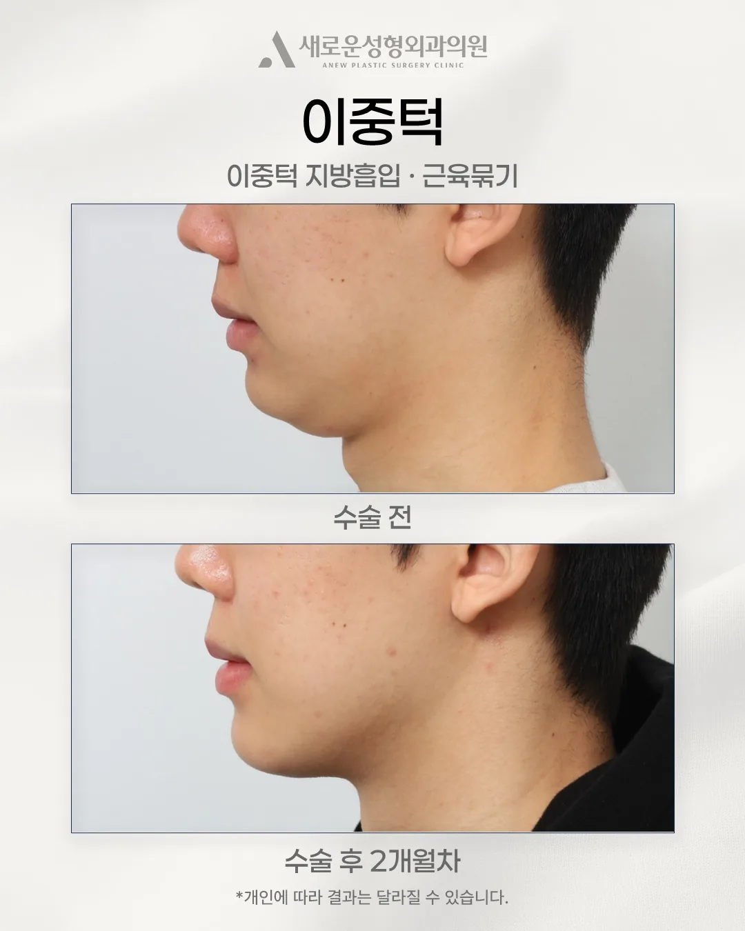 신의선성형외과의원