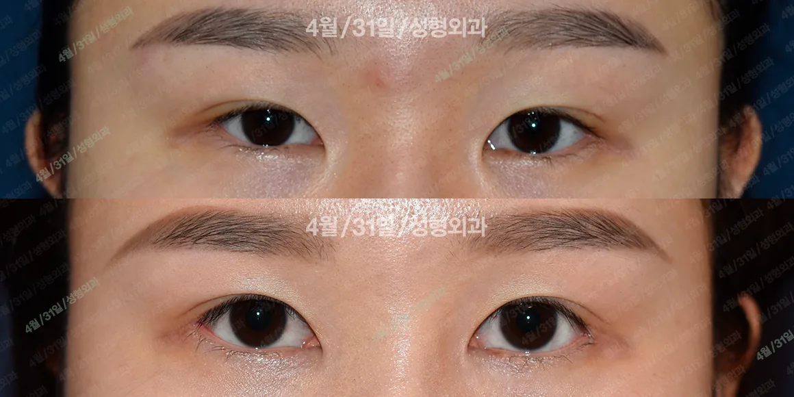 April 31美容外科 症例写真 9