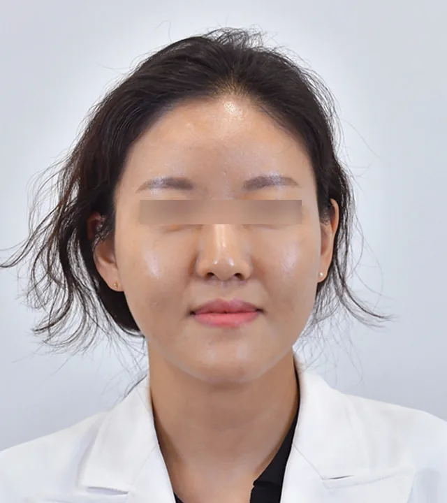 Ca điều trị chính thức 14