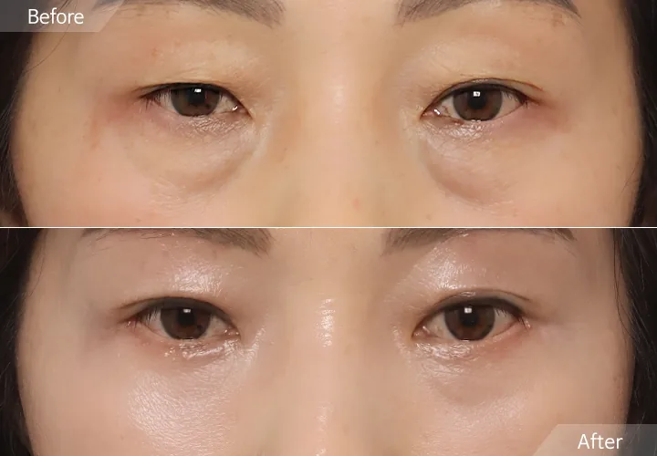 Official before-and-after cases 10