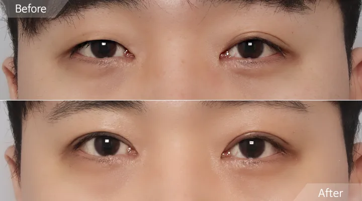 Official before-and-after cases 18