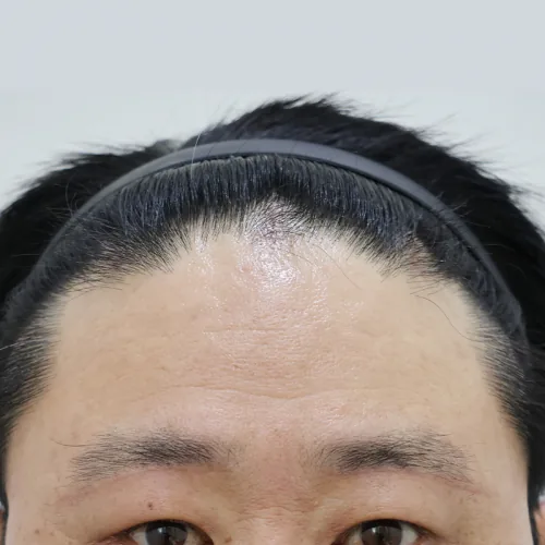 병원 공개 사례 이미지