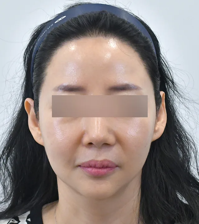 Ca điều trị chính thức 8