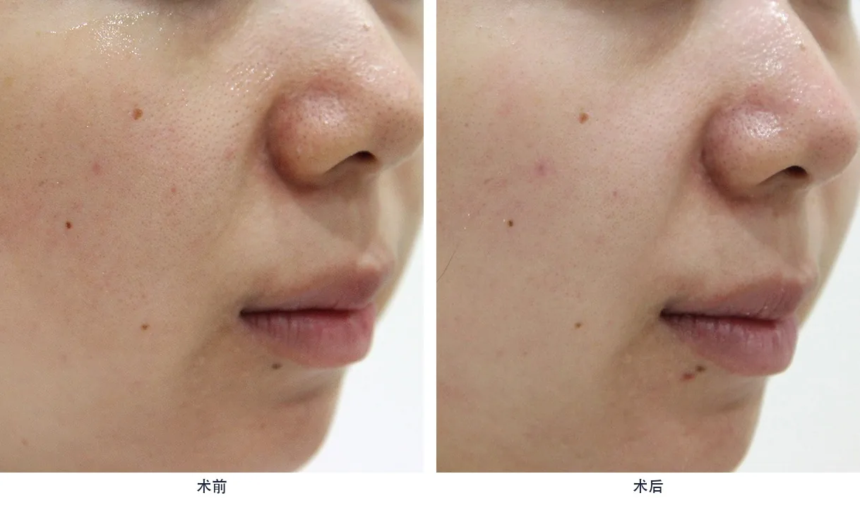 Official before-and-after cases 19