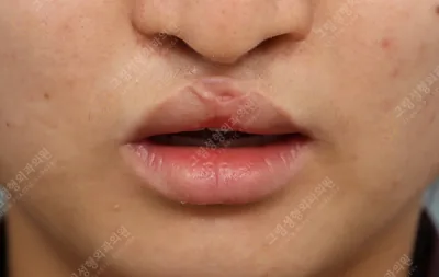 คลินิกศัลยกรรมตกแต่ง Geurim ประเทศเกาหลี