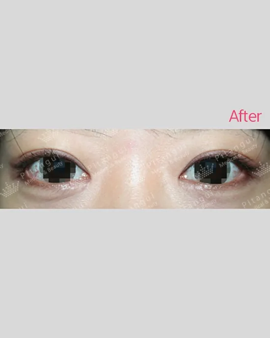 Official before-and-after cases 12