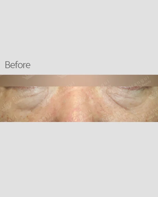 Official before-and-after cases 3
