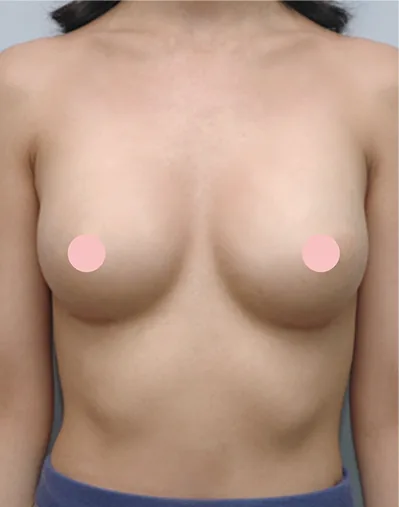 MD Breast Clinic