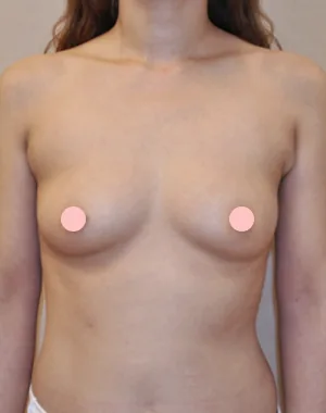 MD Breast Clinic