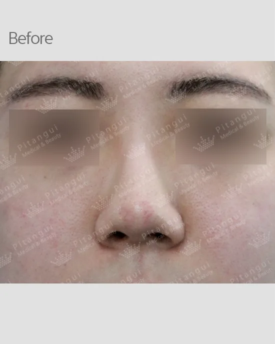 Official before-and-after cases 5