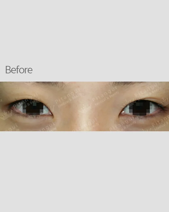 Official before-and-after cases 1