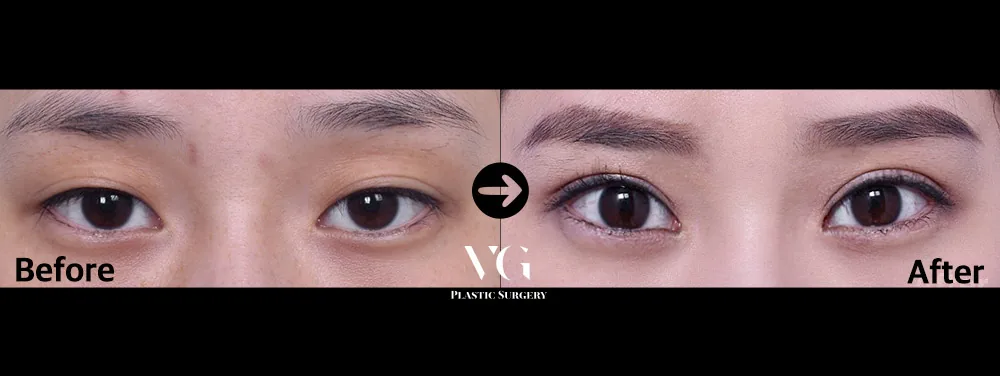 Very Good Plastic Surgery Before-and-after cases 1